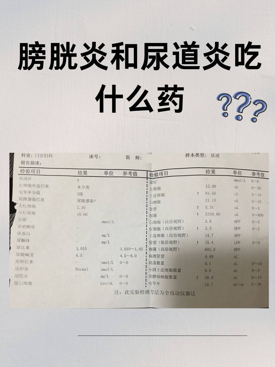 尿急不让尿一直揉膀胱知乎尿急困扰？试试这样做，不让尿急影响你，通过揉膀胱来缓解尿急的痛苦