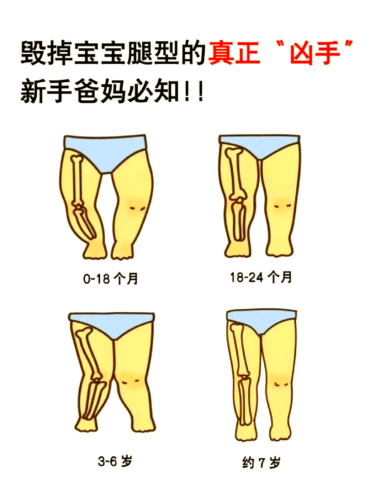 宝宝把腿开大一点就不疼了怎么回事宝宝腿部的舒适调整，开大一点就不疼了-第2张图片