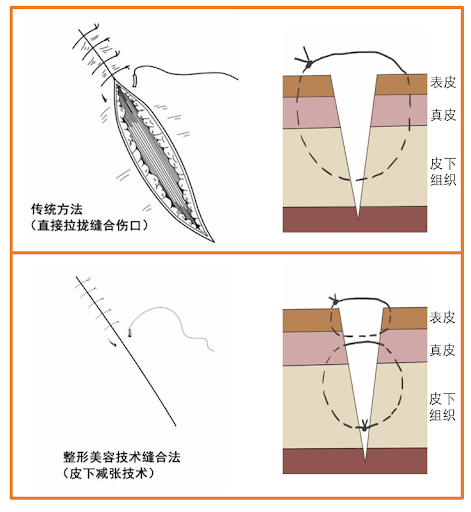 竹板打肿臂缝合不上竹板打伤的痛苦，臂部肿胀与无法缝合的挑战-第2张图片