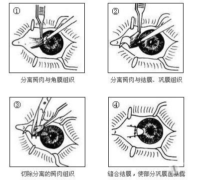 胬肉全文免费阅读成人色情小说的影响与探讨-第2张图片