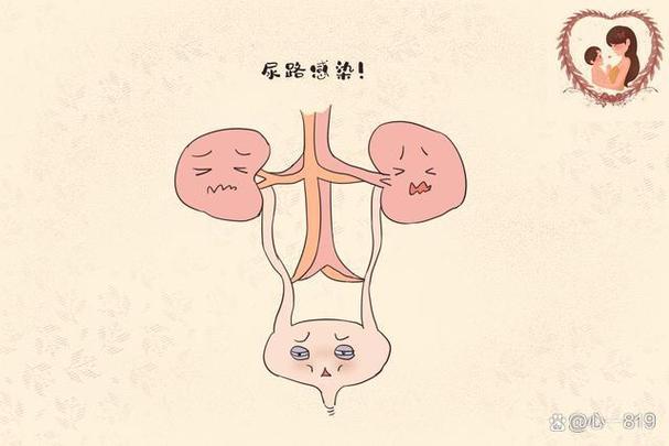 堵住尿孔不能尿_尿堵在尿道口了尿不出来_尿被堵住拉不出来该怎么处理