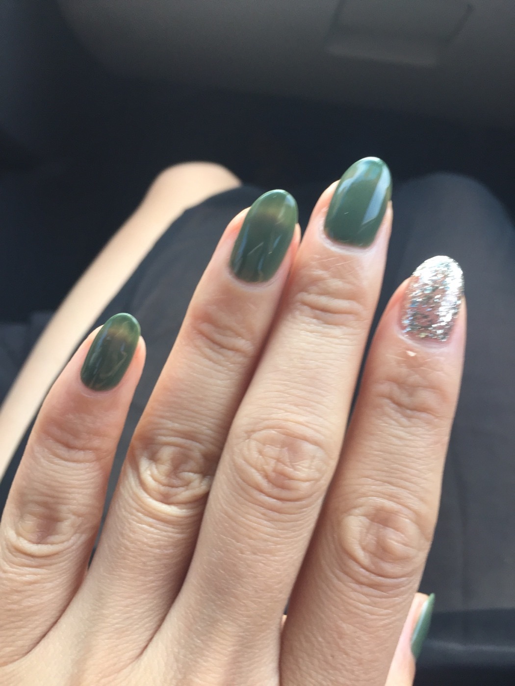 女性三角毛毛区腹部里面疼痛5252女性三角毛毛区腹部疼痛，原因、诊断与治疗