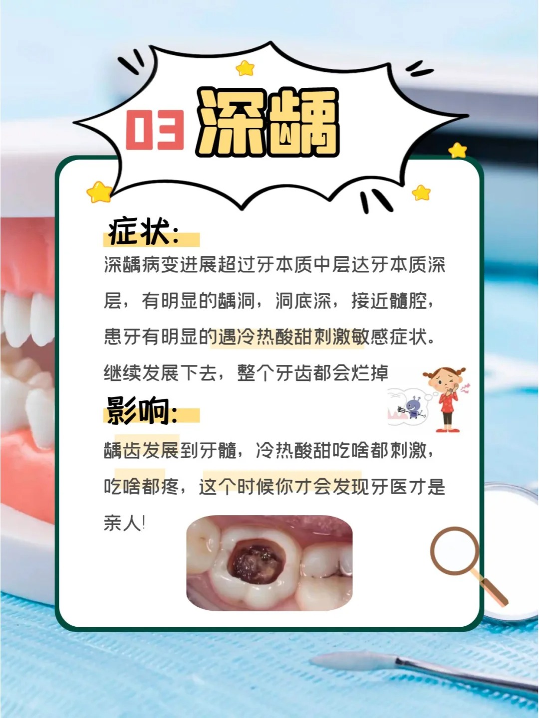 龋齿与蚂蚁庄园，守护口腔健康的小知识-第3张图片